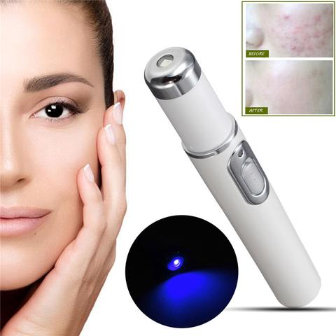 ClearPen™ Blue Light Acne Spot Treatment